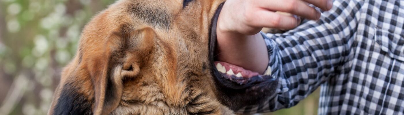 When Man’s Best Friend Attacks: Alabama’s Dog Bite Laws and Liability